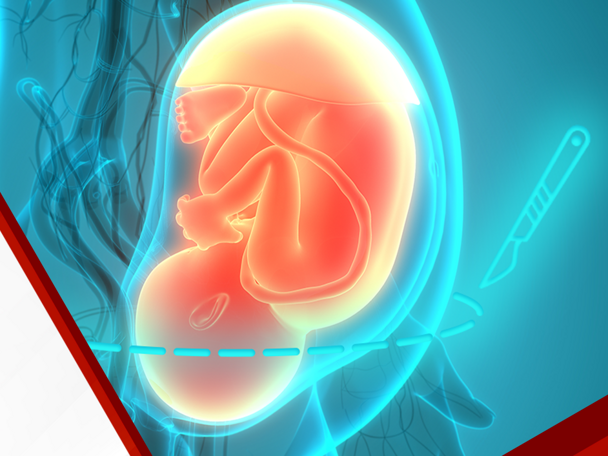 WNSC Learning Lead 2024 C-Section