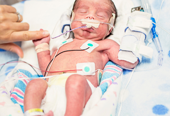 Comparison In Outcomes At Two-Years Of Age Of Very Preterm Infants Born In 2000, 2005 And 2010.