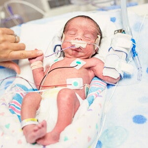 Comparison In Outcomes At Two-Years Of Age Of Very Preterm Infants Born In 2000, 2005 And 2010.