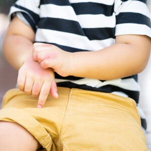 High Levels of N3 and N6 Longchain in Polyunsaturated Fatty Acids in Cord Serum Phospholipids Predict Allergy Development