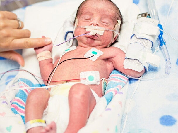 Comparison In Outcomes At Two-Years Of Age Of Very Preterm Infants Born In 2000, 2005 And 2010.